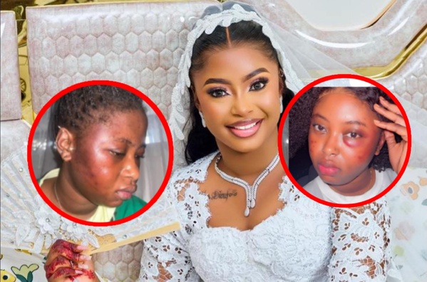 Bousso, brisée par son mariage : « Il m’a maraboutée, frappée et ruinée » Bousso, brisée par son mariage : « Il m’a maraboutée, frappée et ruinée »