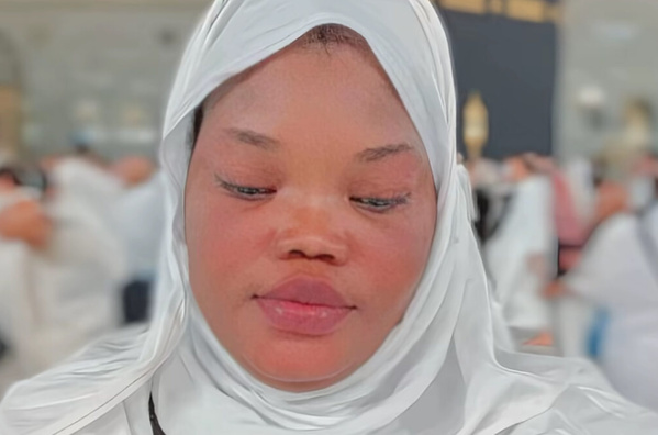 Décès d’eva séduction, influenceuse tiktok : la célèbre vendeuse de produits éclaircissants emportée par une courte maladie Décès d’eva séduction, influenceuse tiktok : la célèbre vendeuse de produits éclaircissants emportée par une courte maladie