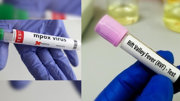 Épidémies de Fièvre de la Vallée du Rift et de Mpox au Sénégal : point de situation au 3 octobre 2025 Épidémies de Fièvre de la Vallée du Rift et de Mpox au Sénégal : point de situation au 3 octobre 2025