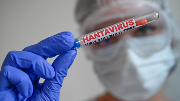 Hantavirus: un touriste ayant transité en France testé positif, aujourd'hui isolé en Espagne Hantavirus: un touriste ayant transité en France testé positif, aujourd'hui isolé en Espagne
