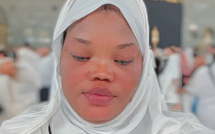 Décès d’eva séduction, influenceuse tiktok : la célèbre vendeuse de produits éclaircissants emportée par une courte maladie